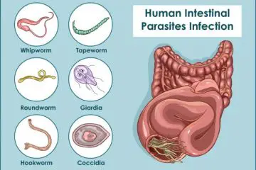 Tapeworms in Humans: Symptoms & Treatment Options