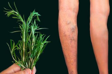 How to Make Alcohol Rosemary That Helps with Gout, Muscle Ache, Varicose Veins, and Cellulite