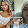 24-Year-Old Diagnosed with Stage 3 Cancer After Overlooking Continous Burping