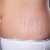 Homemade Lotion Regenerates Cells, Reverses the Signs of Aging and Helps with Cellulite & Stretch Marks