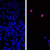 Cancer Breakthrough: Groundbreaking Pill Found to Kill Tumors