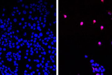 Cancer Breakthrough: Groundbreaking Pill Found to Kill Tumors