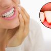 10 Worst Habits: They Cause Bad Breath, Bleeding Gums & Yellow Teeth