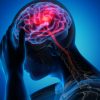 10 Eerie Symptoms That Indicate a Silent Stroke and Another Incoming One