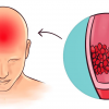 If You Often Struggle with Headaches, Low Energy, and Insomnia, Consider Adding These Vitamins and Minerals