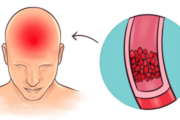 If You Often Struggle with Headaches, Low Energy, and Insomnia, Consider Adding These Vitamins and Minerals
