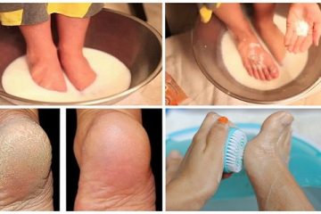 Stop Wasting Money on Pedicures: You Just Need These 2 Ingredients from Your Kitchen & Your Feet Will Look Amazing