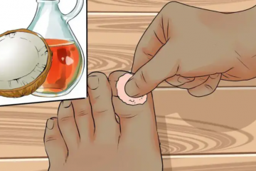 Use This Potent Turmeric & Oil DIY Paste to Get Rid of Ingrown Toenails & Warts