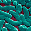 Experts Warn That ‘Flesh-Eating’ Bacteria May Be Spreading to Seafood & Beaches Due to Climate Change