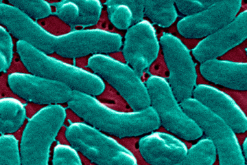 Experts Warn That ‘Flesh-Eating’ Bacteria May Be Spreading to Seafood & Beaches Due to Climate Change