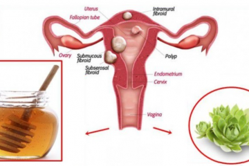 Mix These Two Ingredients & Destroy Any Cysts & Fibroids