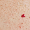Why You Have Red Dots on Your Skin: Causes, Meanings, and Natural Relief