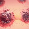Scientists Discover Breast Cancer Cells May Trigger Type 2 Diabetes