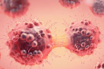 Scientists Discover Breast Cancer Cells May Trigger Type 2 Diabetes