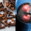 How To Naturally Relieve Toothache With Cloves