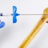 Now hidrogel injection literary strengths bones increasing density by 5x