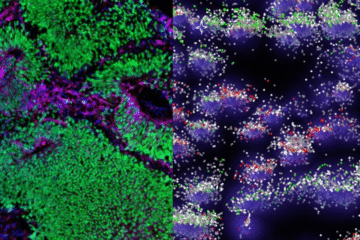 NIH Standardized Organoid Modeling (SOM): What It Is—and Why It Matters for the Future of Health