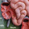 Doctors Were Wrong About the Appendix: Is It Your Body’s Backup Brain?