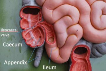 Doctors Were Wrong About the Appendix: Is It Your Body’s Backup Brain?