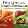 Fatty Liver and Insulin Resistance: The Connection Many People Miss