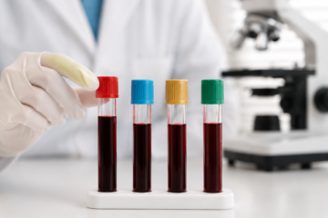 What Your Blood Type May Reveal About Your Health—and What It Can’t Predict