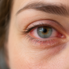 Dry, Burning Eyes? These 7 Natural Changes May Help More Than You Think