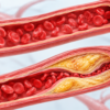 High Cholesterol? These 7 Plants May Help Bring Your Numbers Down Naturally