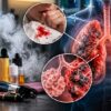 Teenager Who Vaped the Equivalent of 50 Cigarettes a Day Suffers Severe Lung Damage After Coughing Up Blood