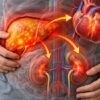 Fatty liver and kidney disease