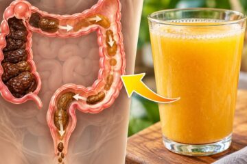 3-Ingredient Colon Cleanse Juice: What Happens When You Drink It?