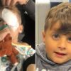 Born Blind, a Boy Gains Sight After Pioneering Gene Therapy